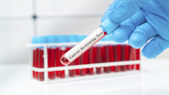 Preliminary Injunction Halts Sales of Tumor-Informed Cancer Screening Test